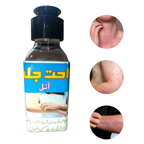 Rahat-e-Jild – 20 Saal Purani Allergy Ka Asli Hal!